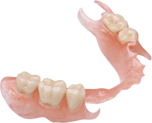 Flexible Partial Denture